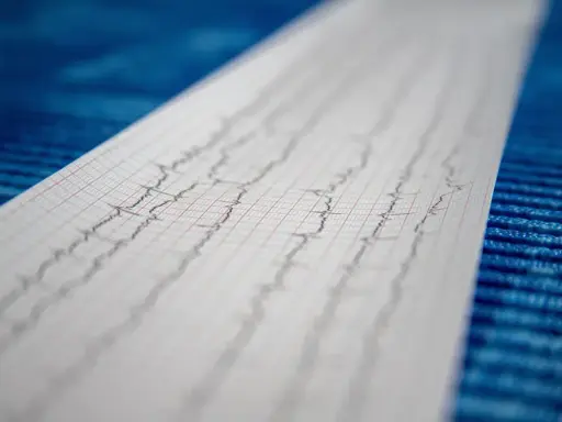 Wynik badania EKG, zapis fal na papierze milimetrowym.