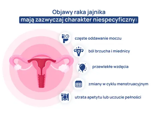 Ilustracja przedstawia narządy rodne kobiety z ikonami symbolizującymi objawy raka jajnika.