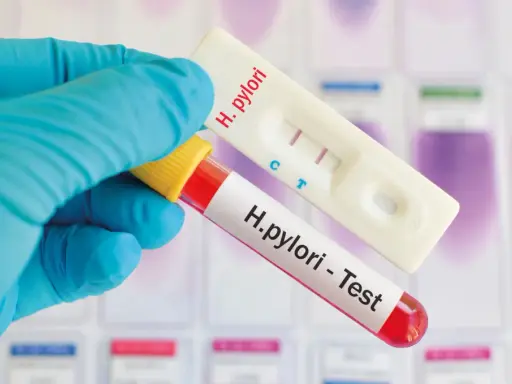 Rękawiczka trzyma probówkę z krwią i test kasetkowy. Dwa paski na teście wskazują, że test ureazowy dodatni.