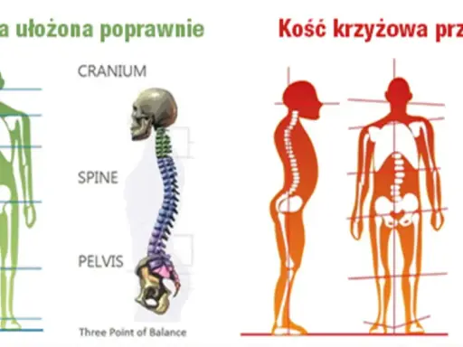Prawidłowe i przechylone ułożenie kości krzyżowej kręgosłupa. Porównanie postawy ciała.