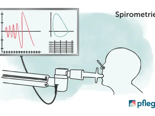 Spirometrie-Diagramm zeigt Lungenfunktion. Wichtig für COPD Gold 3 Rente.