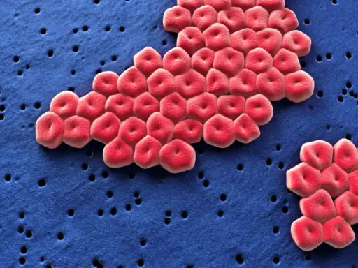 Acinetobacter baumannii, batterio resistente, si guarisce. Globuli rossi rossi su sfondo blu con piccoli fori.