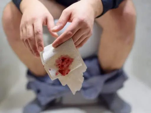 Dłoń trzymająca papier toaletowy z widoczną krwią. To może być objaw problemów zdrowotnych, takich jak krew w stolcu.