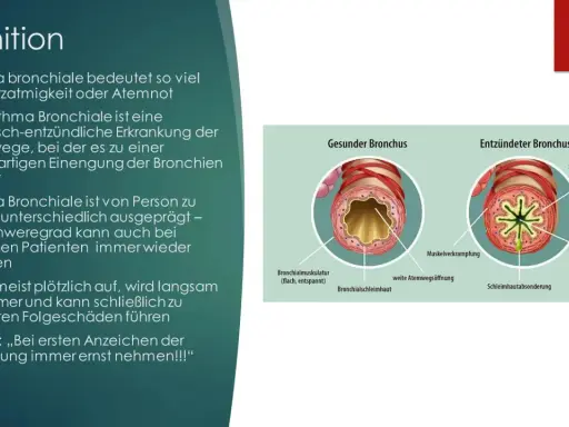 Vergleich gesunder und entzündeter Bronchien. Bei Asthma kommt es zu Muskelverkrampfungen und Schwellungen, die die Atemwege verengen.