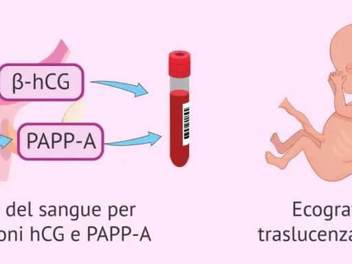 Esami del sangue per ormoni hCG e PAPP-A, ecografia a traslucenza nucale: il tri test per la salute del feto.