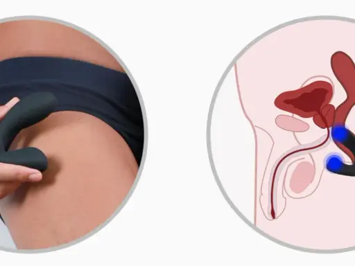 Dwa obrazy: dłoń trzymająca gadżet do masażu prostaty oraz schemat anatomiczny pokazujący jego umiejscowienie.