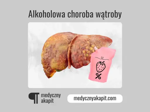 Chora wątroba i woreczek z napisem "%" sugerują, czy alkoholowe zapalenie wątroby jest wyleczalne.