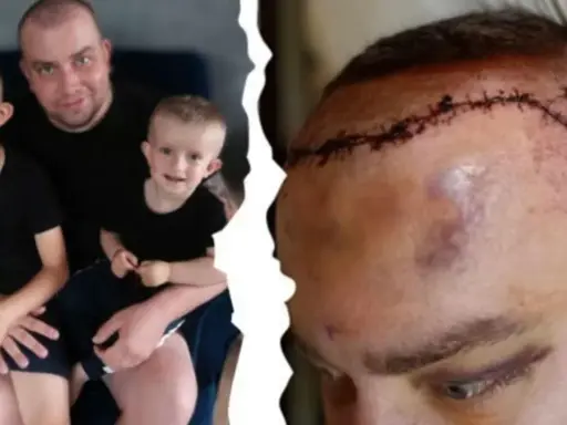 Ojciec z synami, a obok jego głowa po operacji. Historia o tym, jak się umiera na glejaka, jest trudna.