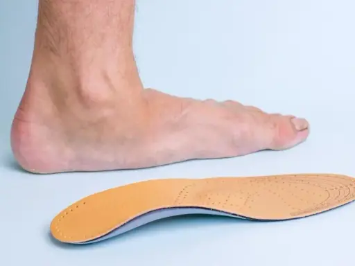 Un pied humain et une semelle orthopédique, conçue pour soulager les douleurs liées aux durillons et aux problèmes de voûte plantaire.