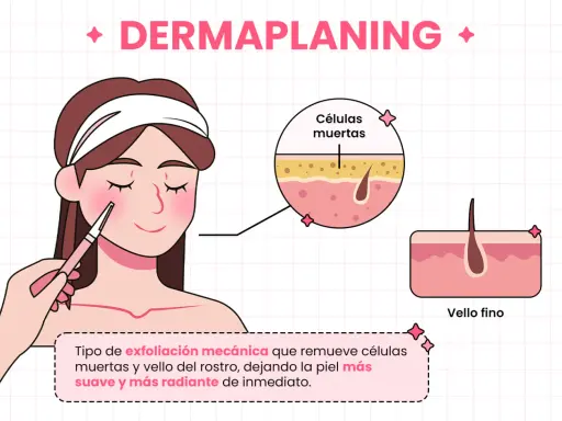 Ilustración de un **dermaplaning facial** que elimina células muertas y vello fino para una piel suave y radiante.