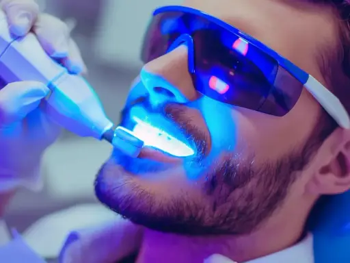 Wybielanie zębów u dentysty: czy warto? Analiza kosztów i efektów