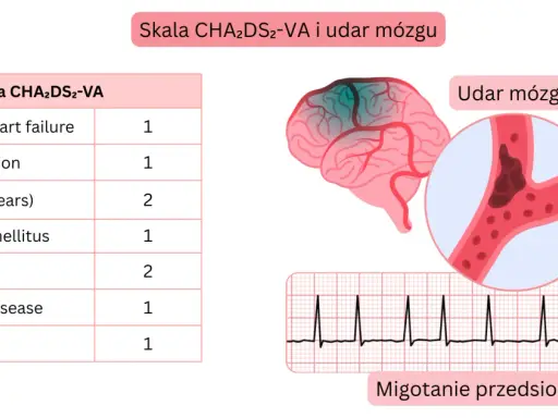 Tabela CHA2DS2-VA, schemat mózgu z udarem, naczynie krwionośne z zakrzepem i EKG.