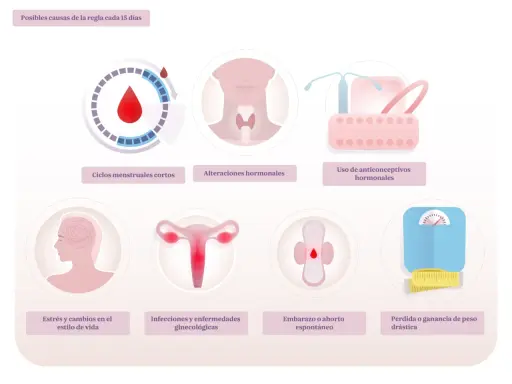 Ilustración muestra posibles causas de la regla cada 15 días: ciclos cortos, alteraciones hormonales, anticonceptivos, estrés, infecciones, embarazo o cambios de peso.