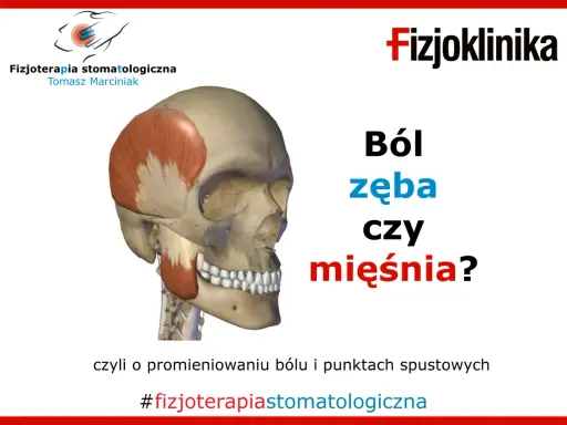 Model czaszki z zaznaczonym mięśniem skrzydłowym przyśrodkowym. Grafika pyta: "Ból zęba czy mięśnia?".