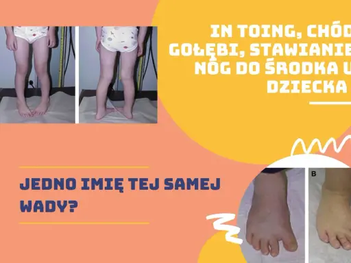 Dziecko z kaczym chodem, stawiające nogi do środka. Dwa zdjęcia pokazują tę samą wadę u dziecka.