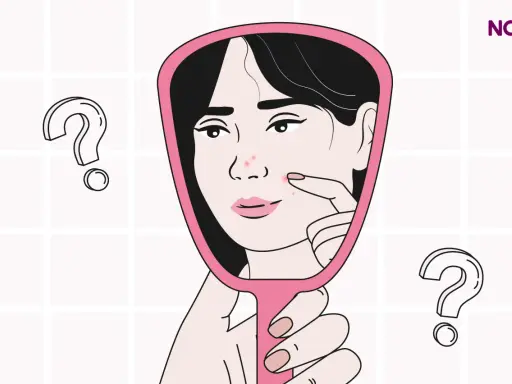 Una mujer se mira en un espejo, examinando granos en su rostro. ¿Será esto un sangrado por deprivación?