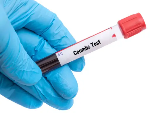 Rękawiczka w niebieskiej rękawiczce trzyma probówkę z krwią do badania. Na etykiecie widnieje napis "Coombs Test", kluczowy dla oceny odczynu Coombsa w ciąży.