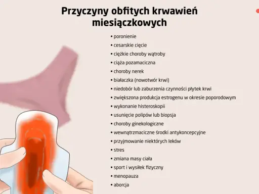 Ilustracja pokazuje podpaskę z krwią, symbolizującą jak wygląda okres. Wymienione są przyczyny obfitych krwawień.