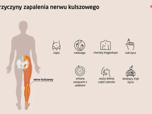 Ból i opuchlizna po przewianiu? To może być zapalenie nerwu!