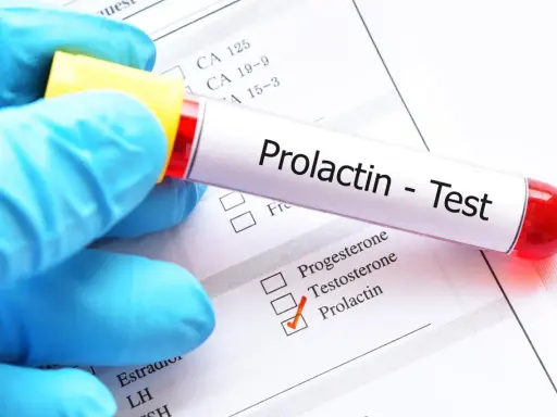 Hiperprolaktynemia: objawy, diagnostyka i jak obniżyć prolaktynę?