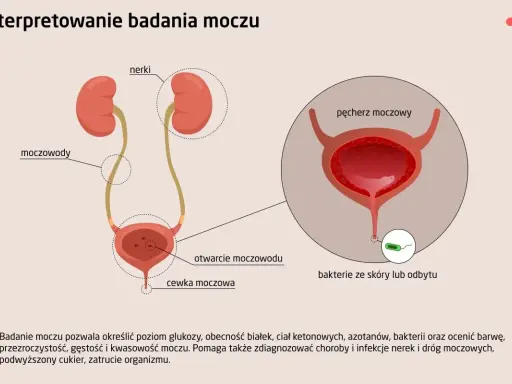 Schemat układu moczowego z nerkami, moczowodami, pęcherzem i cewką. Ilustracja pokazuje różne rodzaje moczu i bakterie.