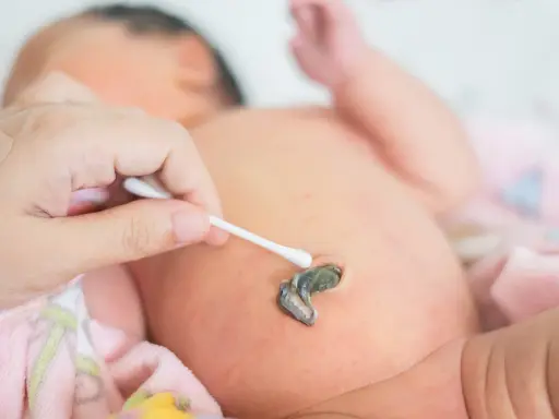 Jak czyścić kikut pępowinowy? Prosty poradnik dla rodziców