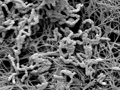 Achromobacter xylosoxidans, batteri filamentosi che colonizzano una matrice extracellulare fibrosa.