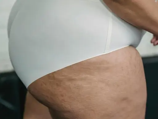 Zbliżenie na grube uda z widocznymi rozstępami, podkreślające naturalne piękno ciała.