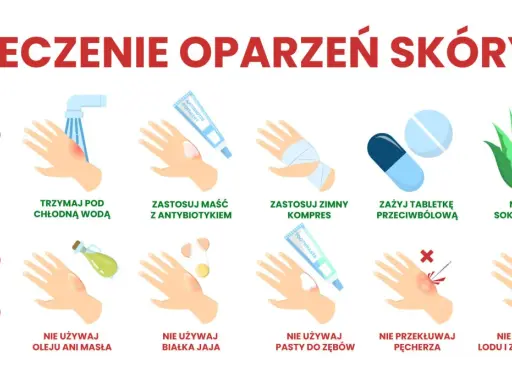Leczenie oparzeń skóry: chłodna woda, maść z antybiotykiem, zimny kompres, leki przeciwbólowe, aloes. Unikaj masła, jajek, pasty do zębów, przekłuwania pęcherzy, lodu.