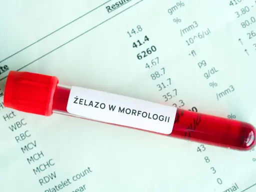 Probówka z krwią na tle wyników morfologii. Etykieta "ŻELAZO W MORFOLOGII" sugeruje badanie pod kątem przyczyn niedoboru żelaza.