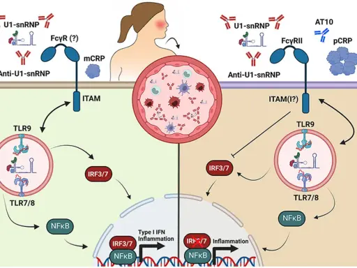 Schema illustra meccanismi infiammatori mediati da anticorpi anti-U1-snRNP e proteina C reattiva (pCRP).