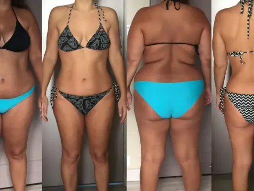 Avant/après : une femme en bikini montre sa silhouette, avec une perte de hanches visible.