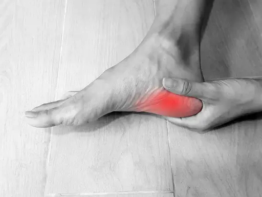 Pie con dolor en el talón, simulando fascitis plantar en niños.