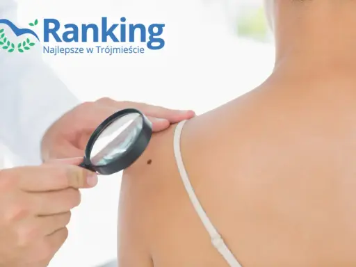 Dermatolog ogląda pieprzyk pod lupą na ramieniu pacjentki.