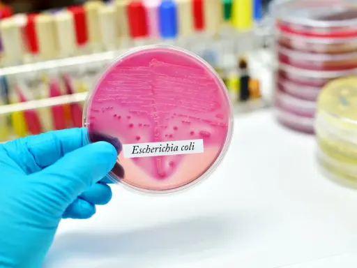 Różowa pożywka z koloniami bakterii Escherichia coli. Badanie laboratoryjne pomaga wykryć bakteria coli objawy.