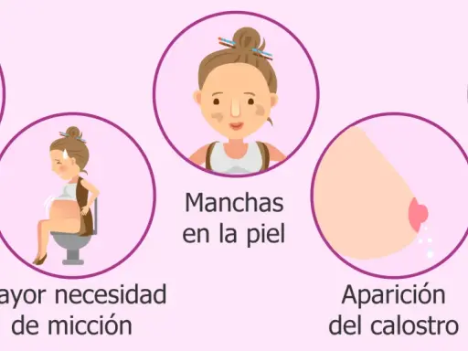 Ilustración de síntomas de embarazo: estrías, mayor necesidad de micción, manchas en la piel, aparición del calostro y problemas de espalda.