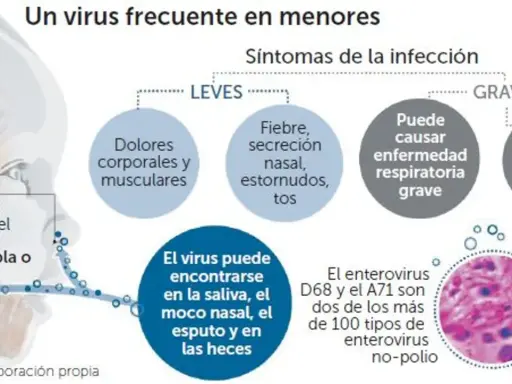 Infografía sobre enterovirus en niños, detallando síntomas leves y graves, dónde se encuentra el virus y tipos específicos como D68 y A71.