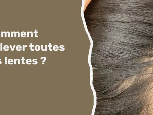 Gros plan sur des cheveux sombres infestés de lentes. Le texte "Comment enlever toutes les lentes ?" apparaît à gauche, avec des illustrations de poux en bas.