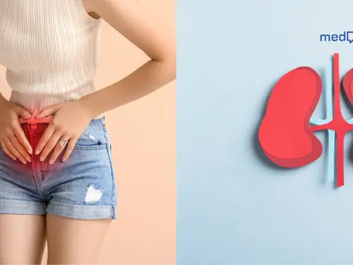 Kobieta z bólem w podbrzuszu i symbol nerek. Gdy czujesz ból, pomyśl o antybiotyku na nerki.