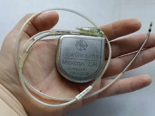 Dłoń trzyma kardiowerter Medtronic Maximo DR, urządzenie podobne do rozrusznika serca, z dwoma elektrodami.
