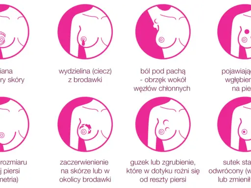 Grafika pokazuje objawy raka piersi: guzek, zmiany skórne, wydzielinę z brodawki, ból, wgłębienia, asymetrię, zaczerwienienie i odwrócony sutek.
