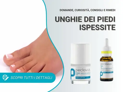 Piedi con unghie ispessite. Soluzioni e rimedi per la cura delle unghie dei piedi.