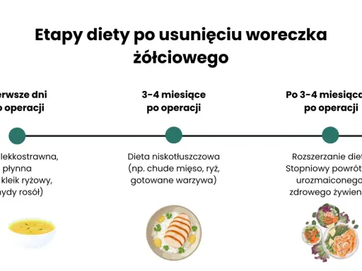 Etapy diety po operacji woreczka żółciowego: płynna dieta lekkostrawna, potem niskotłuszczowa, aż do powrotu do zdrowego żywienia.