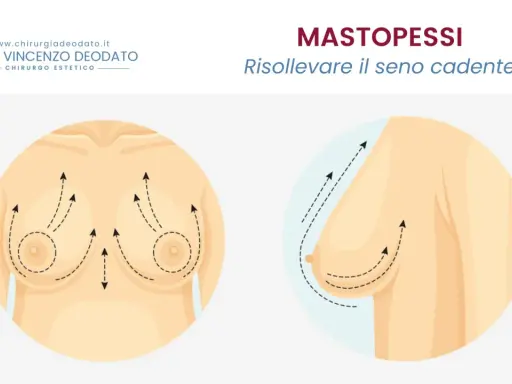 Mastopessi: solleva il seno cadente. Immagine illustra il seno prima e dopo il sollevamento, con frecce che indicano il movimento verso l'alto.