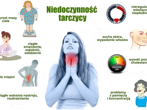 Objawy niedoczynności tarczycy: przyrost masy ciała, zmęczenie, bóle mięśni, wahania nastroju, sucha skóra, wypadanie włosów, problemy z pamięcią.