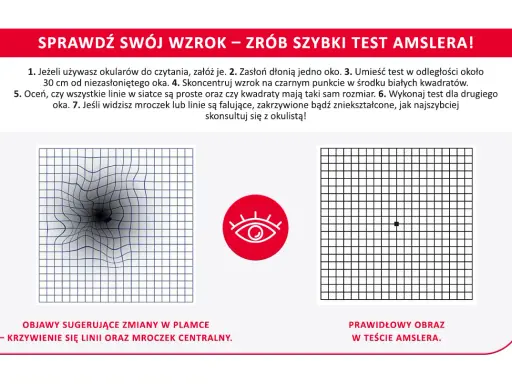 Test Amslera: zniekształcone linie i mroczek centralny to objawy sugerujące zmiany w plamce. Plamka bez refleksu co to znaczy? Skonsultuj się z okulistą.