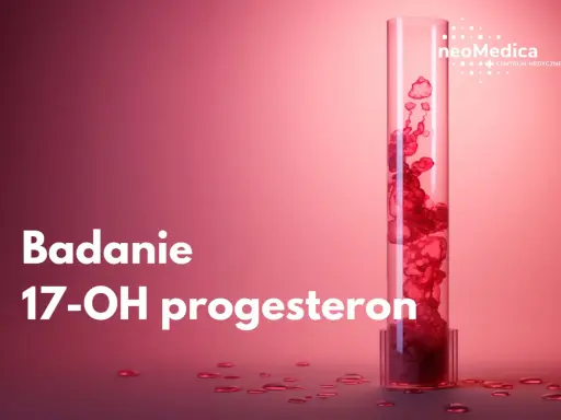 Badanie 17-OH progesteron. Podwyższony poziom może wiązać się z objawami takimi jak trądzik czy nadmierne owłosienie.
