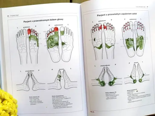 Ilustracje pokazują punkty na dłoniach odpowiadające narządom, używane w terapii refleksologicznej.