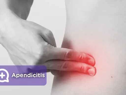 Apendicitis: ¿Dolor común o urgencia? Identifica los síntomas clave.