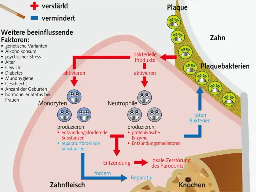 Das Diagramm zeigt, wie sich das Zahnfleisch nach Rauchstopp regeneriert. Es erklärt die Rolle von Monozyten und Neutrophilen bei Entzündung und Reparatur.